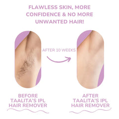 IPL Hair Remover | Hair-Free Skin in Just Weeks
