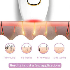 IPL Hair Remover | Hair-Free Skin in Just Weeks